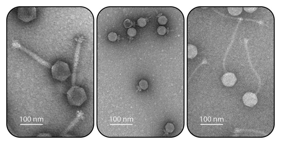 This photos shows three electron micrographs of bacterial viruses, also known as phages
